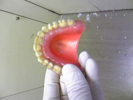 マイクラ 人気アイテム コピーデンチャーの作り方 予防歯科ブログ clinic dental moriura : 語学・辞書・学習参考書