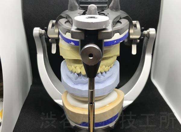 の 人気アイテムランキング 咬合器 : 渋谷歯科技工所 健康/医学