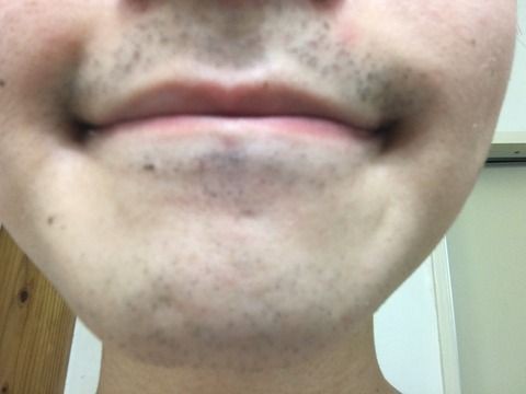 ヒゲ脱毛前日 大学生の僕の決意 男子力up研究所 Com