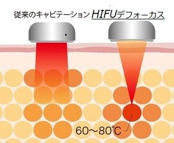 千葉初登場 Di Focus ディフォーカス のジョジョ風cmを作ってみた This Is A Poker 人生は理不尽の連続だ