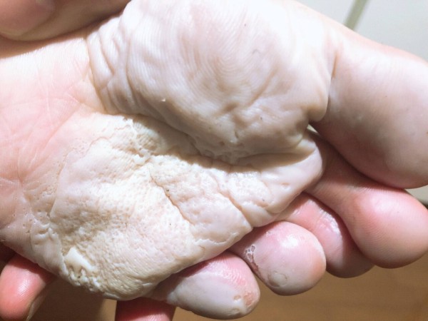 閲覧注意 オレの足の裏がやばいことになってるんだけど うしみつ 2ch怖い話まとめ