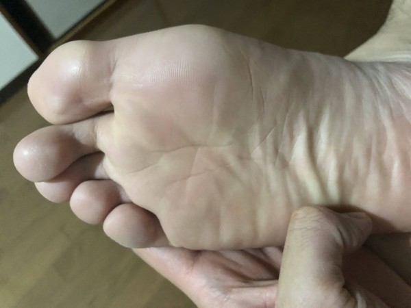 閲覧注意 オレの足の裏がやばいことになってるんだけど うしみつ 2ch怖い話まとめ