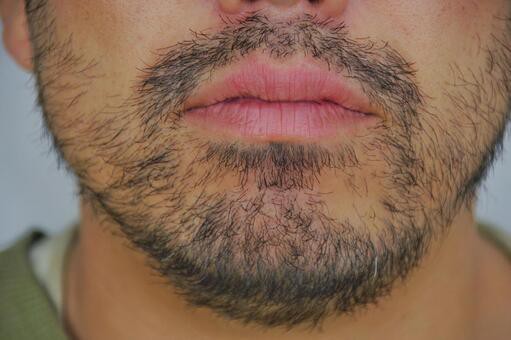 驚愕 ひげを抜くのが癖になった結果ｗｗｗｗｗｗｗ Vip News