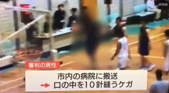 炎上 バスケ 審判ぶん殴った黒人留学生 とんでもない供述をする Vipまとめ速報