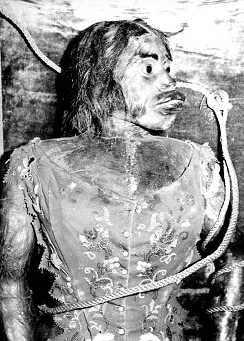 世界一醜い女性 の遺体故郷へ 多毛症で見せ物小屋 死んでもミイラにされ世界を廻る 日刊ニログ