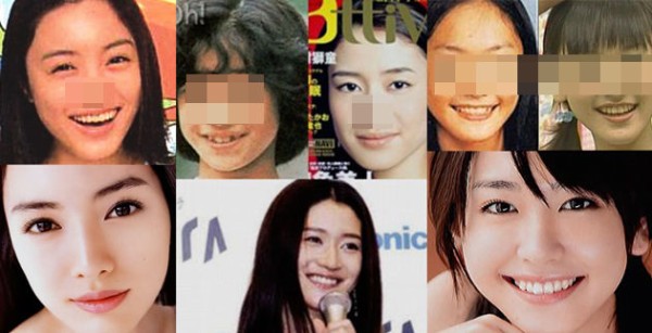 画像あり 結構いた 鼻を整形した芸能人特集 話題のニュースまとめ