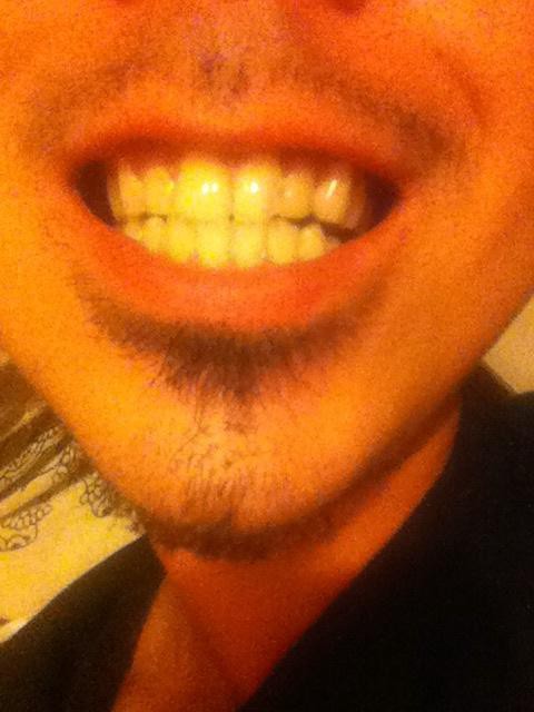 俺より歯並び悪い奴いんの 歯列矯正したい Warazone ワラゾーン