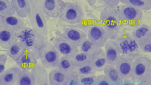 ヒヤシンスの細胞分裂の観察 : Web247