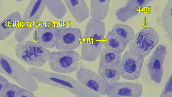 ヒヤシンスの細胞分裂の観察 : Web247