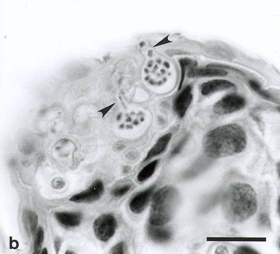 Chytridiomycosis2