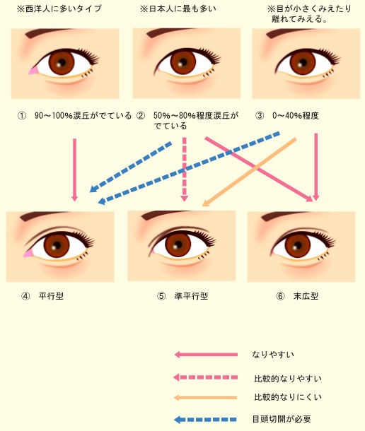 あの芸能人は知っている 絶対に失敗しない二重プチ整形とは 二重整形 まとめ