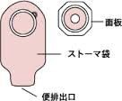 装具はワンピースとツーピースから選択 ニシヒロ クローン病