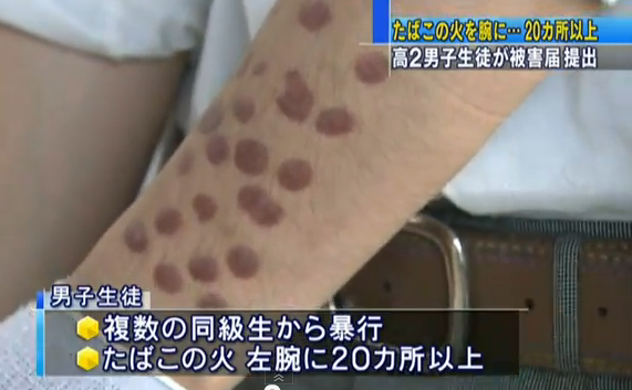 ネット炎上 新潟 新潟県教育委員会と県立高校の校長は記者会見し いじめと認定した 心からおわびする と謝罪した 加害者の女子生徒はネット炎上で不登校中 いまどきニュースno1