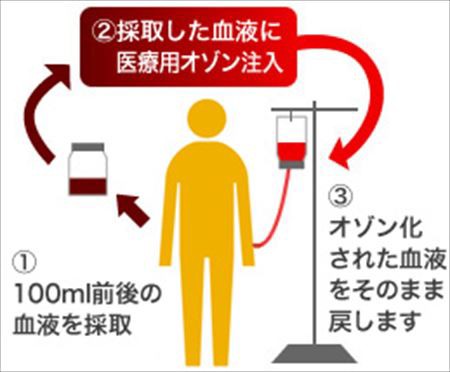 癌の治療法その２ 矢口壹琅 の One Love