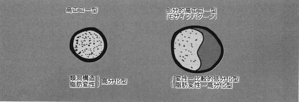 2nd step超音波診断「肝」:宮本 幸夫、辻本 文雄 : yanchangの