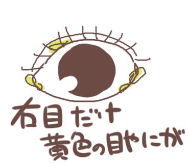 ７ヶ月赤ちゃんの鼻涙管閉塞 難病ママのくもりときどき晴れ