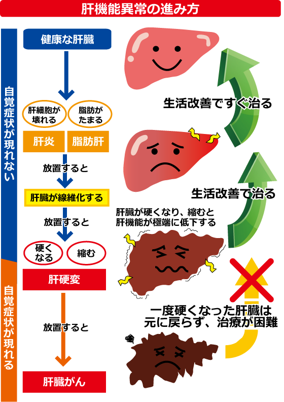 酒を飲み過ぎると肝臓の劣化度を示す G Gtp の数値がここまで上がるらしい 0超えた時点で肝臓ﾎﾞﾛﾎﾞﾛ 嬢速